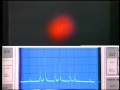 Laser Transverse Modes