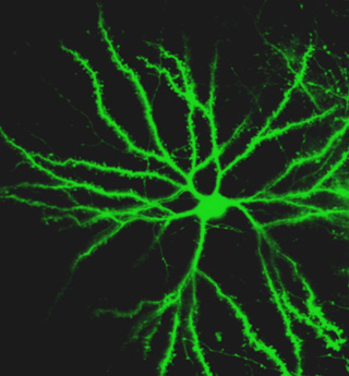 Bright fluorescent green jagged lines branching off of a central point.